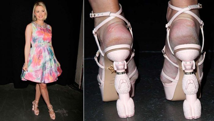 The model Holly Madison ruined the uncomfortable Charlotte Olympia sandals with sheep heels cause of pumice and moisturizer.
